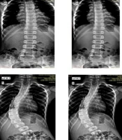 Middle East J Rehabil Health Stud